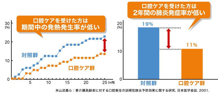 口腔ケアは誤嚥性肺炎予防に有効です