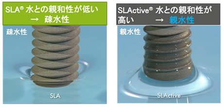 SLActive-何が違うのか?